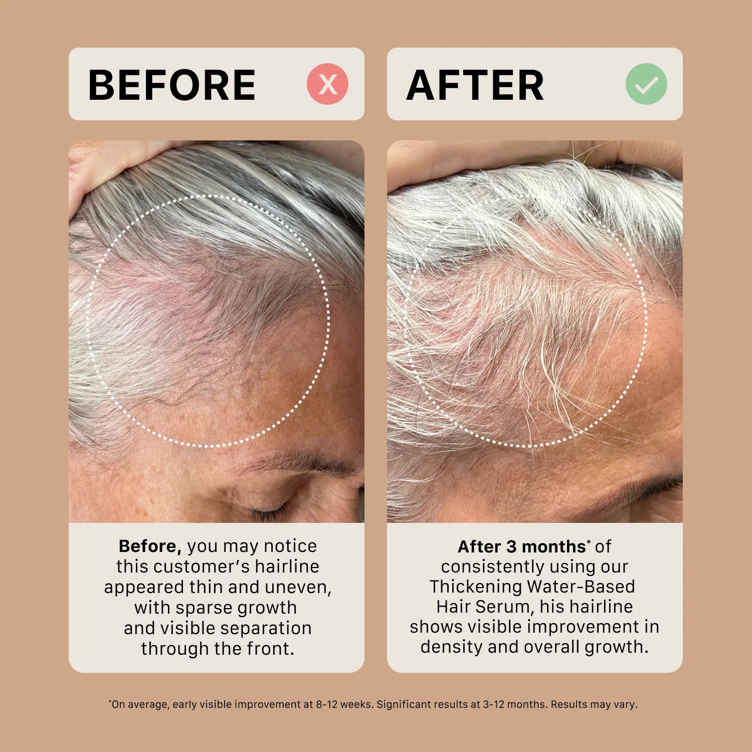 Sérum capillaire épaississant à base d'huile - Cheveux texturés