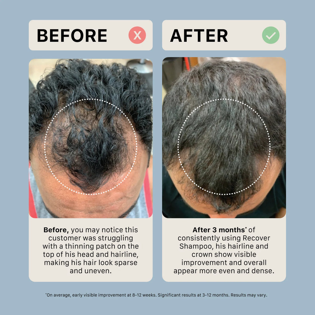 Shampoing traitement épaississant pour homme - Recover