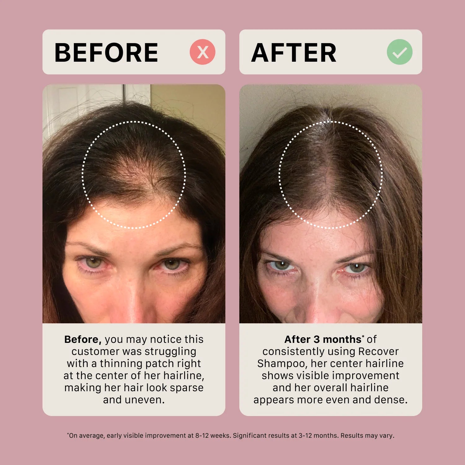 Shampoing traitement épaississant pour femme - Recover